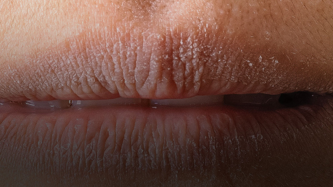 Wieso haben wir trockene Lippen?