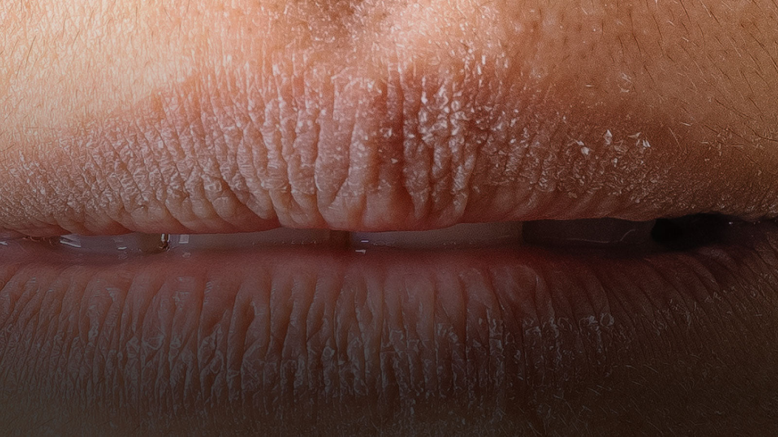 Wieso haben wir trockene Lippen?